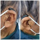 군산유니트론보청기 이미지