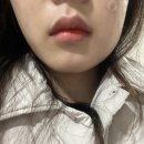 [성남 사랑니 발치 치과]나의특별한치과의원(20대사랑니발치, 주차, 내돈내산)