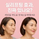 실리프팅 효과 후기, 40~50대 리프팅 시술 전 꼭 보세요!