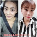 이혈 테라피 이미지