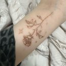 청담라인약국 | 문신제거 주사마취 4회차 클리닉 후기 &amp; 경과 비교 (강남 압구정 청담 피부과 피코레이저 내돈내산 가격...