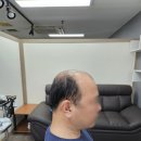 부산가발 맞춤으로 편안하게