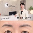 눈높이성형외과 이미지
