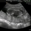 [네이트톡] 21살 임신 5개월째.. 노약자석에 앉았다가..ㅠㅠ.. 이미지