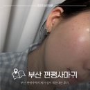 서면한의원 | 부산편평사마귀성지 서면한의원 내돈내산 제거 후기