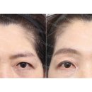 에스에이치(SH)성형외과의원 이미지