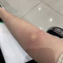 SOK수지속편한내과의원 네이버블로그