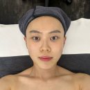 토파즈성형외과 | [대구] 얼굴형이 고민이라면 - 라플러스에스떼