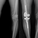 수사랑병원 이미지