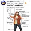 살아있는게 신기한 WWE 믹폴리 역대 부상부위.jpg 이미지