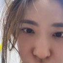 마곡나루역 피부과 피코슈어 줌패스 후기