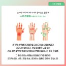 수부 이미지