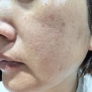 올어바웃스킨 | 얼굴열감내리기 고민 끝! 어바웃셀 쿨링앰플로 여름 피부 진정 케어 후기