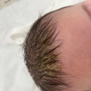 코디케어 | 신생아 아기 지루성피부염 두피염 관리 방법 및 개선 후기