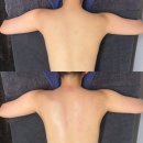 4공단플러스정비 | [대구 대명동 신부관리] 라플러스에스떼 팔뚝살 관리 일부 내돈내산 후기 (추가금/주차)