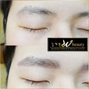 김채원W뷰티 이미지