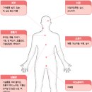 아나필락시스[anaphylaxis] 이미지