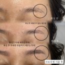 후후브로 이미지