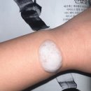 촘촘 스칼프 이미지