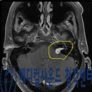 청신센타 이미지