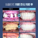 강남애프터치과 이미지
