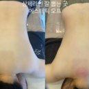 S라인피부관리샵 네이버블로그