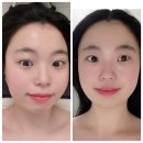 광원빌딩 | [안산선부동피부관리] 웨딩관리 대만족 후기 더예쁠예정에스테틱