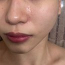 성북-종암-1422 | 종암동 피부샵, 올가드림뷰티 종암점 :: PDRN, 리프팅, 비타민 관리 칙칙했던 피부에 형광등 켜기!