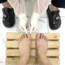 남동22 | [인천 남동구]구월동레푸스 내성발톱 관리 후기