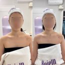 케이엠필라테스 | 천안웨딩관리 케이엠에스테틱에서 민서쌤에게 수기 윤곽관리 받고 온 후기