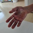 예손병원 | 미용인 남편 손 골절로 다녀온 부천예손병원 진료 후기 1탄 | 수부외과 첫 방문 기록