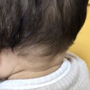 행복한어린이병원 | 아기 목 멍울 혹 대학병원 진료 후기 (양산 부산대학교 어린이병원)