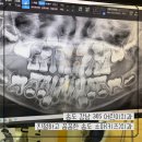 송도굿모닝치과의원 | 친절하고 꼼꼼한 송도 어린이 치과 - 송도 오네스타 강남365어린이치과