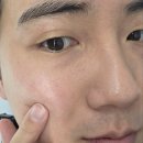 신 기 | [르랩] 포스트 프로시져 시카크림 ｜ 피부 재생크림 추천 시카케어 얼굴 붉은기 진정 후기