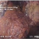 괴물 신드롬 이미지