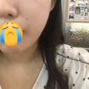 올곧은치과의원 | 은평구 야간진료 매복 사랑니치과추천(올곧은치과)