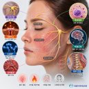 장신경과의원 | 신경성 주사피부염 치료 후기｜하루 21시간 지속되던 얼굴 열감·홍조·붉은 발진 호전