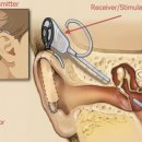 와우보청기 이미지