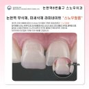 스노우기공소 이미지