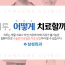 치루개 이미지
