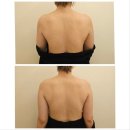 길 메디스 | 용인 기흥 피부관리샵 #메디스파연 #상체관리 후기