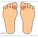 신광준혹달린신발