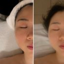 더맨즈룸 | 한티역피부관리 세레니끄 대치점 리프팅관리 후기