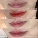 자연스러운 입술문신 (시술전, 시술후, 1달뒤, 3달뒤까지)