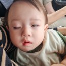 외안 | 선천성 안검하수 수술 1년+차의 후기(외안)