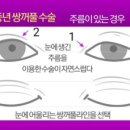 채종훈성형외과의원 이미지
