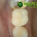 허브치과기공소 이미지