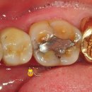 비타민치과기공소 이미지