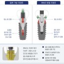 율하사랑심는치과의원 | 접착제 없이 임플란트 보철을 올리는 방식(세멘리스 보철. SNUC시스템) / 세미나 후기