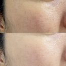 강서필병원 | 강서구 까치산 피부관리 라라필 속광 3종패키지 {라포레뷰티}